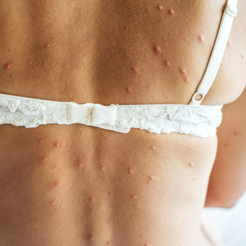 éradication de punaises de lit à Paris 15